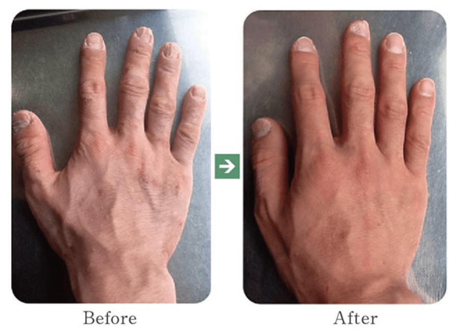 ビフォーアフター